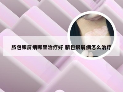 脓包银屑病哪里治疗好 脓包银屑病怎么治疗