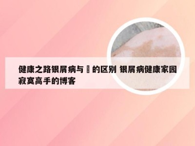 健康之路银屑病与廯的区别 银屑病健康家园寂寞高手的博客