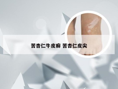 苦杏仁牛皮癣 苦杏仁皮尖