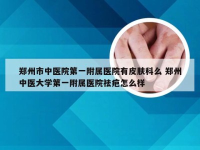 郑州市中医院第一附属医院有皮肤科么 郑州中医大学第一附属医院祛疤怎么样