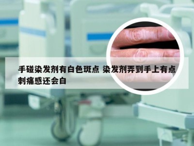 手碰染发剂有白色斑点 染发剂弄到手上有点刺痛感还会白