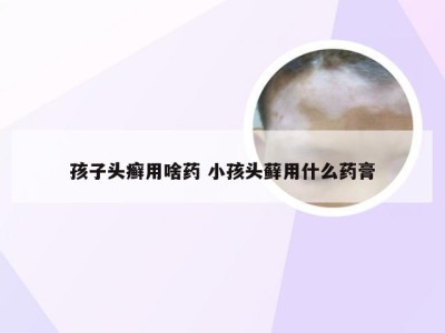 孩子头癣用啥药 小孩头藓用什么药膏