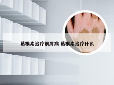 葛根素治疗银屑病 葛根素治疗什么