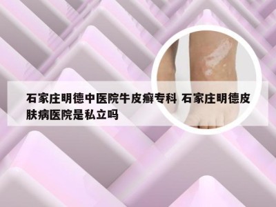 石家庄明德中医院牛皮癣专科 石家庄明德皮肤病医院是私立吗