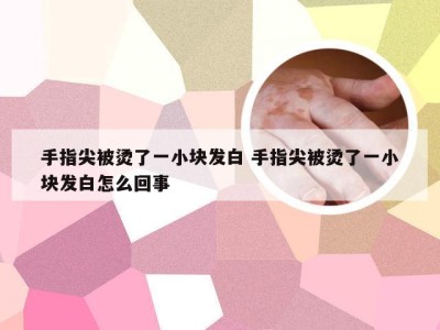 手指尖被烫了一小块发白 手指尖被烫了一小块发白怎么回事