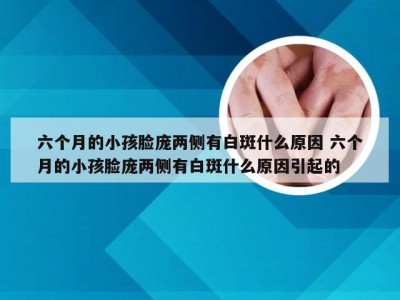 六个月的小孩脸庞两侧有白斑什么原因 六个月的小孩脸庞两侧有白斑什么原因引起的