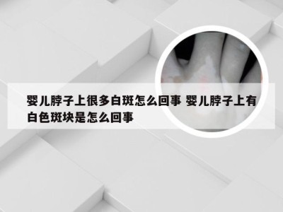 婴儿脖子上很多白斑怎么回事 婴儿脖子上有白色斑块是怎么回事