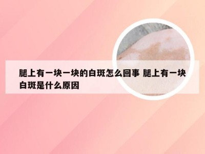 腿上有一块一块的白斑怎么回事 腿上有一块白斑是什么原因