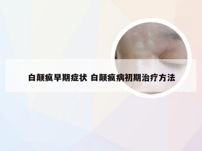 白颠疯早期症状 白颠疯病初期治疗方法