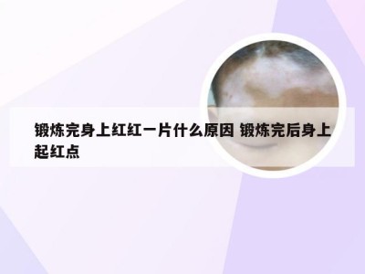 锻炼完身上红红一片什么原因 锻炼完后身上起红点