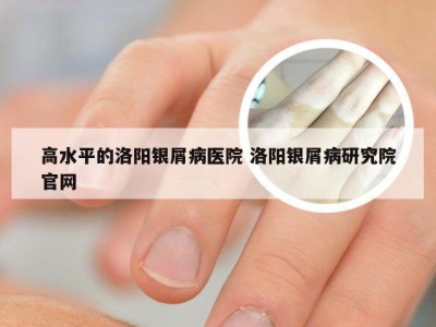 高水平的洛阳银屑病医院 洛阳银屑病研究院官网