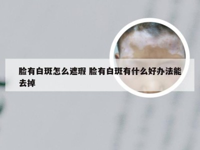 脸有白斑怎么遮瑕 脸有白斑有什么好办法能去掉