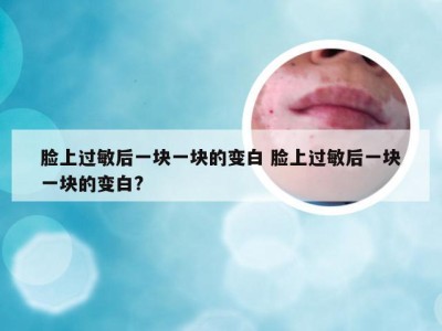 脸上过敏后一块一块的变白 脸上过敏后一块一块的变白?