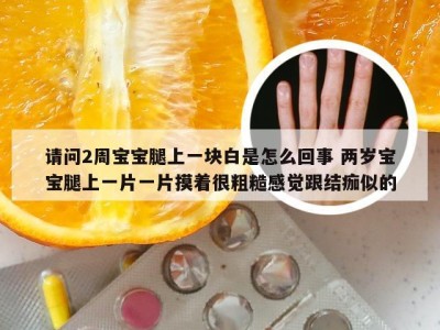 请问2周宝宝腿上一块白是怎么回事 两岁宝宝腿上一片一片摸着很粗糙感觉跟结痂似的