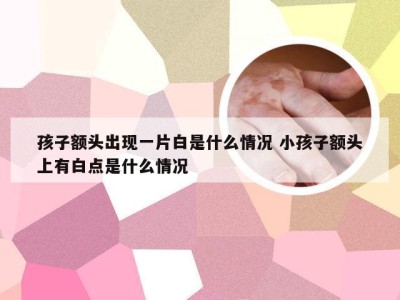 孩子额头出现一片白是什么情况 小孩子额头上有白点是什么情况