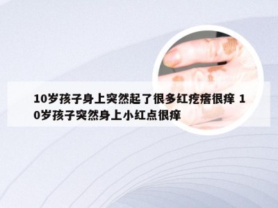 10岁孩子身上突然起了很多红疙瘩很痒 10岁孩子突然身上小红点很痒