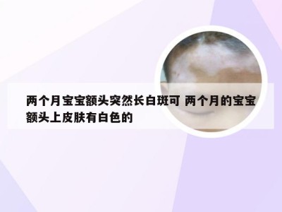 两个月宝宝额头突然长白斑可 两个月的宝宝额头上皮肤有白色的