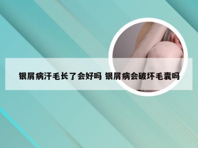 银屑病汗毛长了会好吗 银屑病会破坏毛囊吗