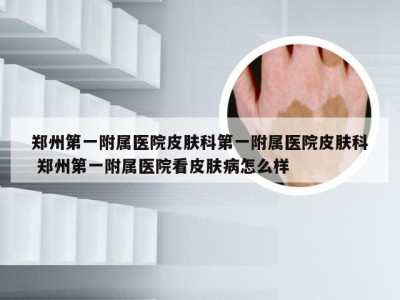 郑州第一附属医院皮肤科第一附属医院皮肤科 郑州第一附属医院看皮肤病怎么样