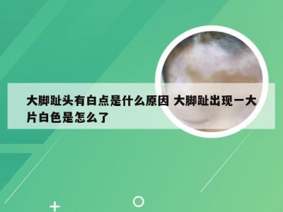 大脚趾头有白点是什么原因 大脚趾出现一大片白色是怎么了