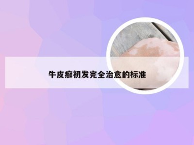 牛皮癣初发完全治愈的标准