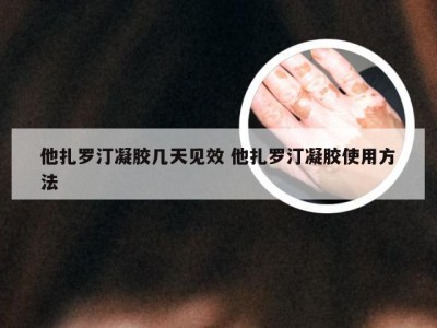 他扎罗汀凝胶几天见效 他扎罗汀凝胶使用方法