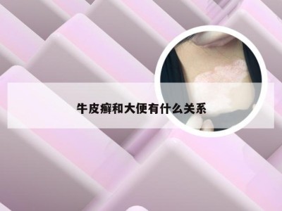 牛皮癣和大便有什么关系