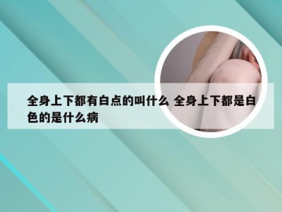 全身上下都有白点的叫什么 全身上下都是白色的是什么病