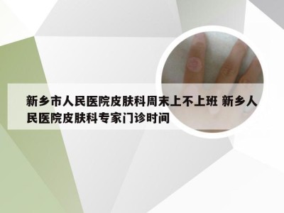 新乡市人民医院皮肤科周末上不上班 新乡人民医院皮肤科专家门诊时间