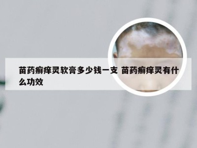 苗药癣痒灵软膏多少钱一支 苗药癣痒灵有什么功效