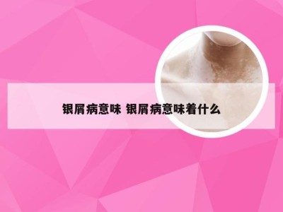 银屑病意味 银屑病意味着什么