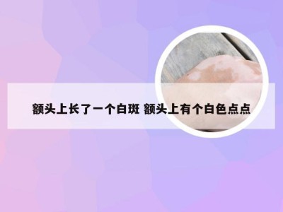 额头上长了一个白斑 额头上有个白色点点