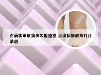 点滴状银屑病多久能痊愈 点滴状银屑病几月消退