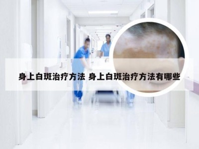 身上白斑治疗方法 身上白斑治疗方法有哪些