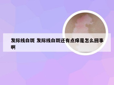 发际线白斑 发际线白斑还有点痒是怎么回事啊