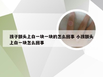 孩子额头上白一块一块的怎么回事 小孩额头上白一块怎么回事