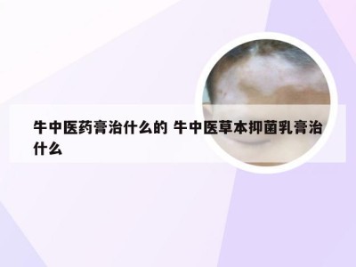 牛中医药膏治什么的 牛中医草本抑菌乳膏治什么