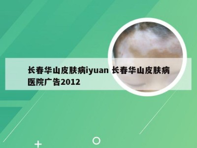 长春华山皮肤病iyuan 长春华山皮肤病医院广告2012