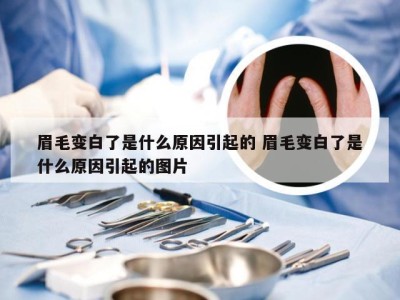 眉毛变白了是什么原因引起的 眉毛变白了是什么原因引起的图片