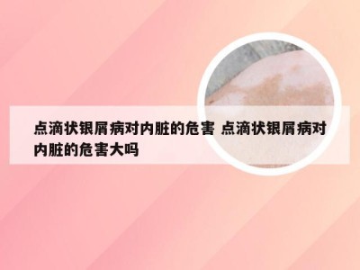 点滴状银屑病对内脏的危害 点滴状银屑病对内脏的危害大吗