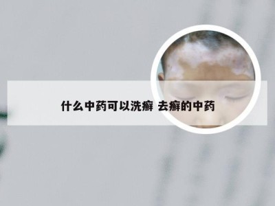 什么中药可以洗癣 去癣的中药