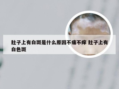 肚子上有白斑是什么原因不痛不痒 肚子上有白色斑