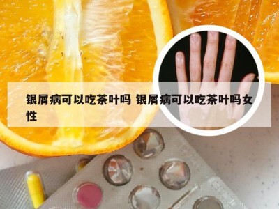 银屑病可以吃茶叶吗 银屑病可以吃茶叶吗女性