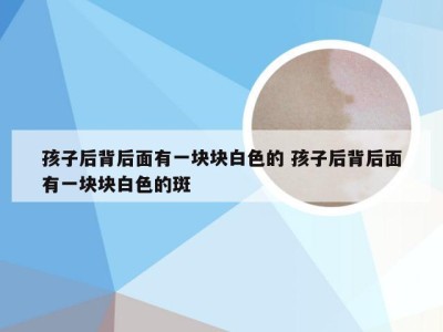 孩子后背后面有一块块白色的 孩子后背后面有一块块白色的斑